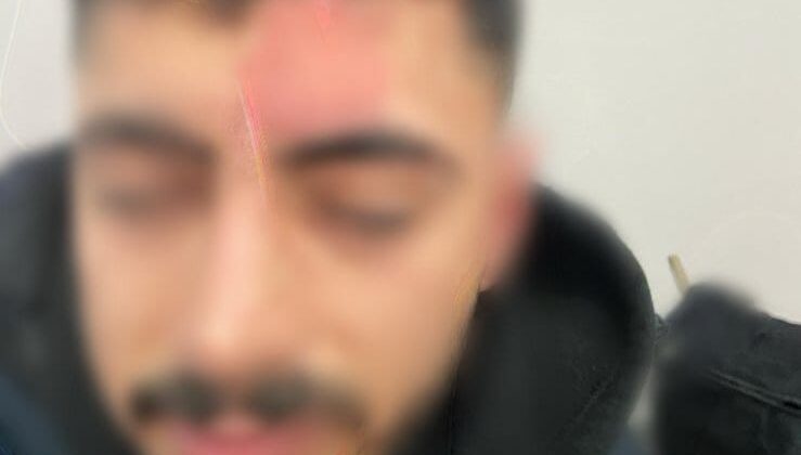 Diyarbakır’da Newroz kutlamasında darp iddiası: “Siyasi faaliyetim nedeniyle hedef oldum”